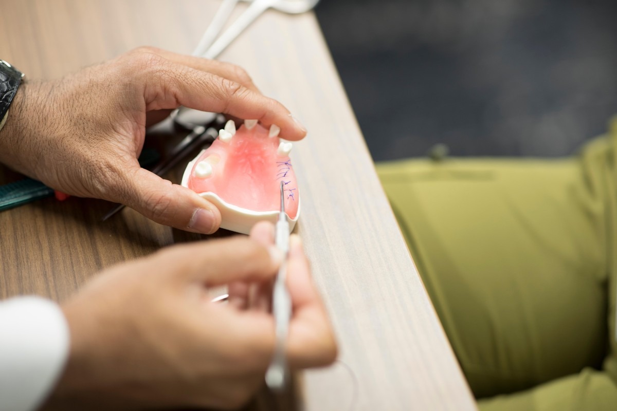 aspen dental product image